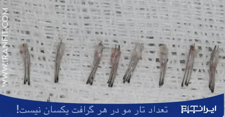 گرافت مو با تعداد متفاوت تار مو