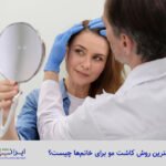 بهترین روش کاشت مو برای خانم‌ ها - کلینیک کاشت و پیوند مو ایران فیت