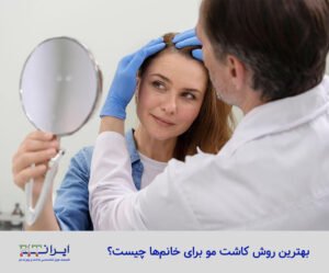 بهترین روش کاشت مو برای خانم‌ ها - کلینیک کاشت و پیوند مو ایران فیت