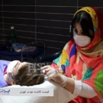 قیمت کاشت مو در تهران - کلینیک کاشت و پیوند مو iranfit