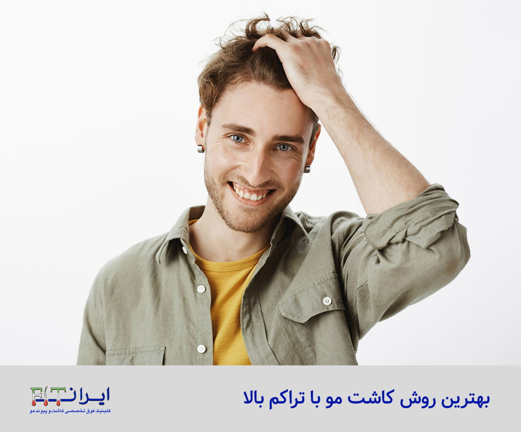 بهترین روش کاشت مو با تراکم بالا - کلینیک کاشت مو ایران فیت