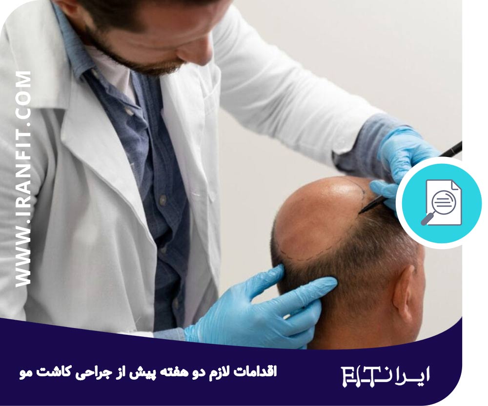 اقدامات لازم دو هفته پیش از جراحی کاشت مو 