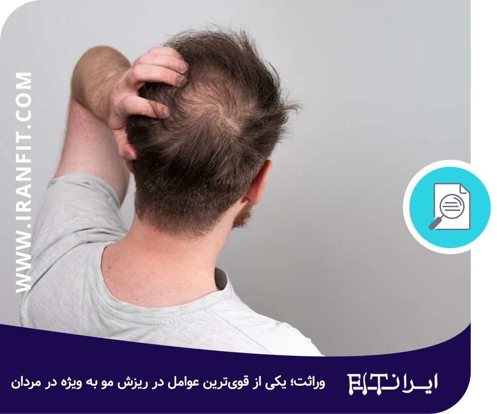 علت ریزش مو در مردان جوان چیست؟ ژنتیک و وراثت