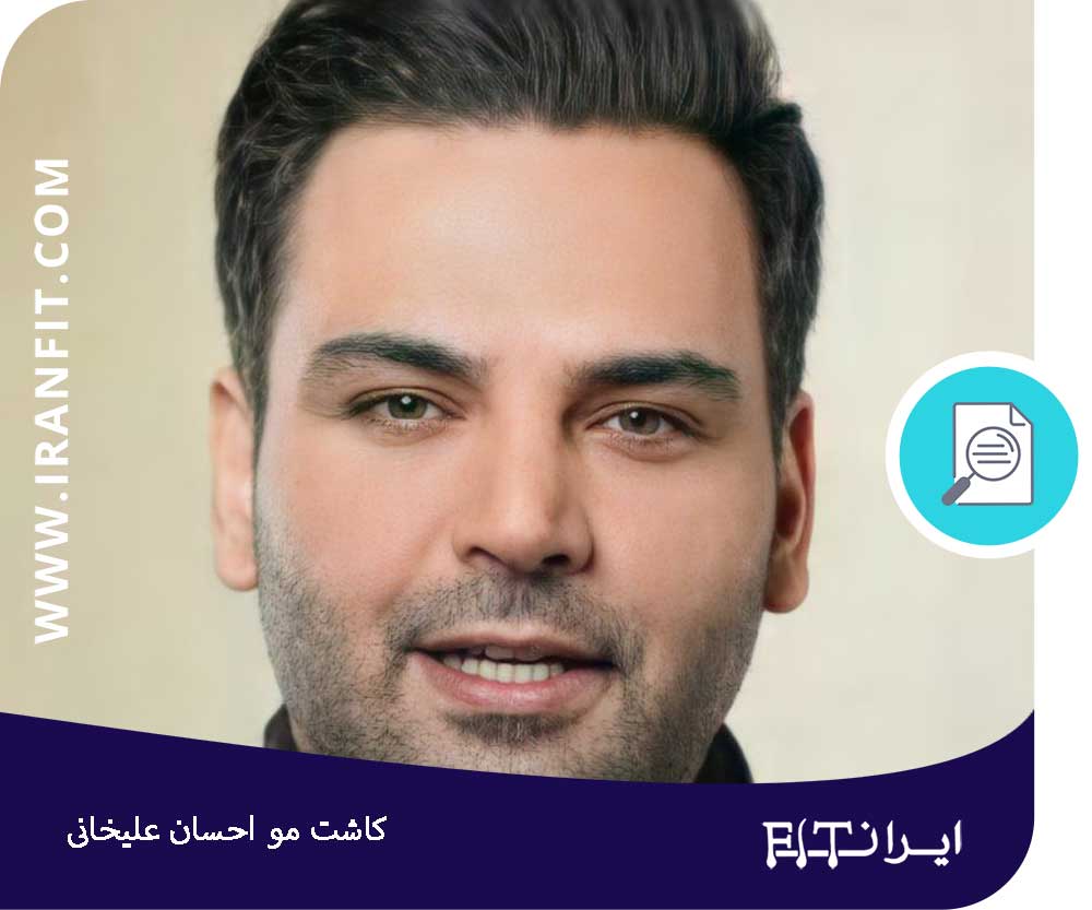 کاشت مو احسان علیخانی