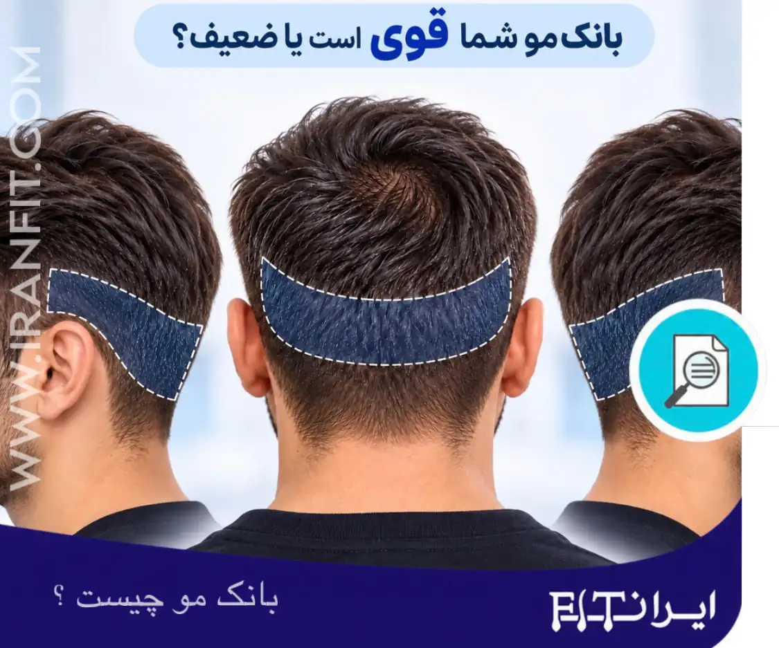 بانک مو چیست و چه ویژگی دارد