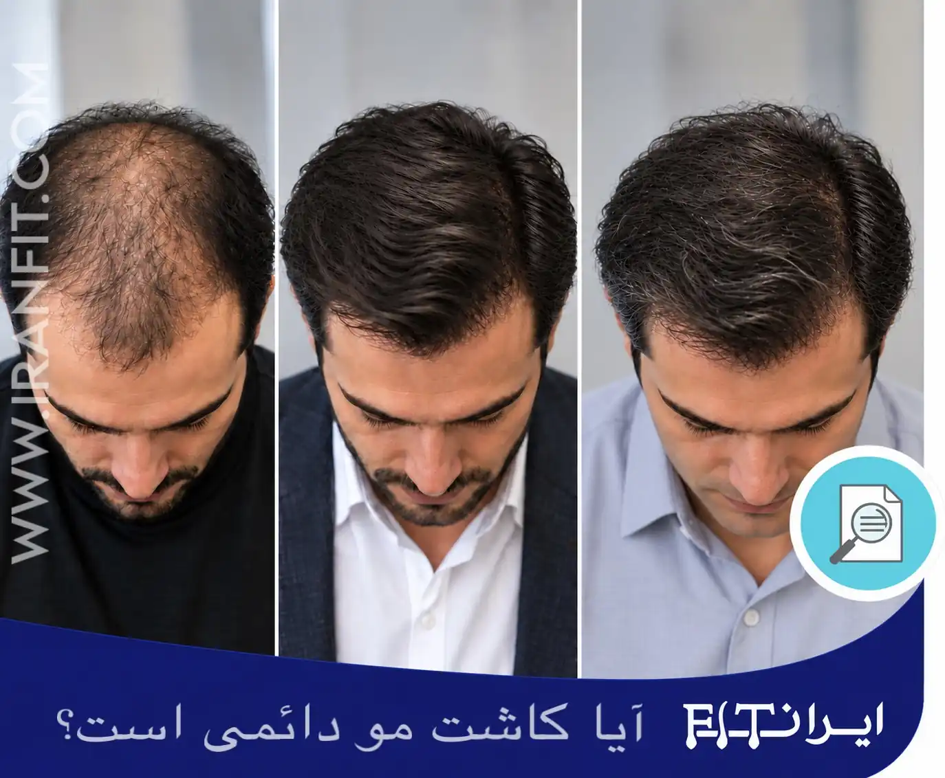 مقایسه قبل و بعد و 10 سال بعد