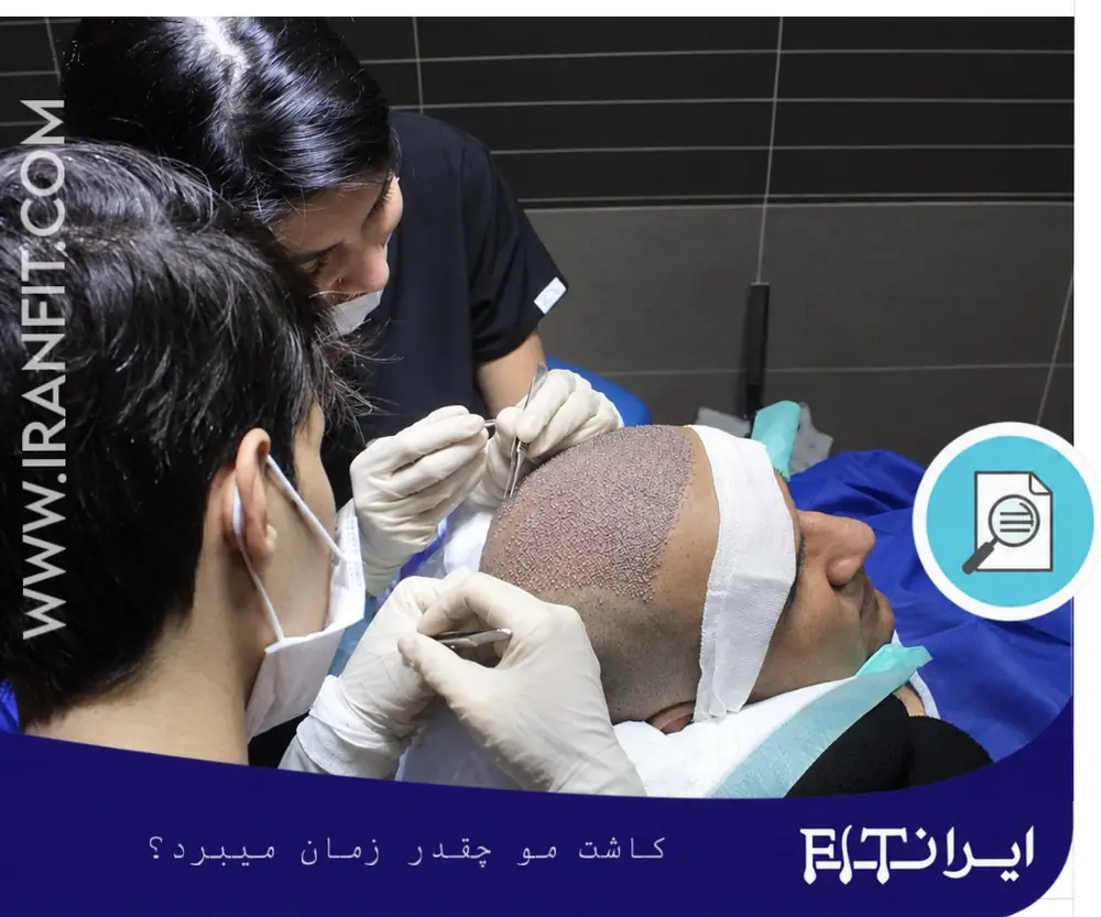 کاشت مو چقدر زمان میبرد ؟ تصویر واقعی عمل